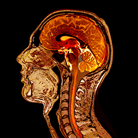 Whole body MRI scan for comprehensive longevity health screening